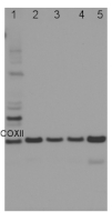 COXII | Cytochrome oxidase subunit II (200 µg) in the group Antibodies for Plant/Algal  / Mitochondria | Respiration at Agrisera AB (Antibodies for research) (AS04 053A-200)